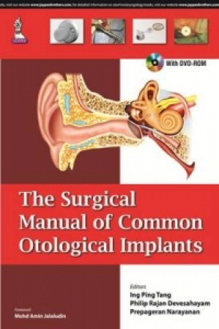 Kniha Surgical Manual of Common Otological Implants ING PING TANG