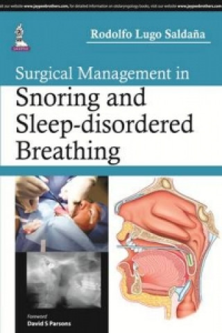 Carte Surgical Management in Snoring and Sleep-disordered Breathing Rodolfo Lugo Saldana