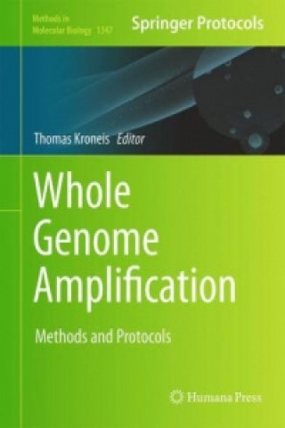 Kniha Whole Genome Amplification Thomas Kroneis