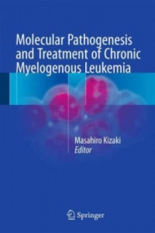 Książka Molecular Pathogenesis and Treatment of Chronic Myelogenous Leukemia KIZAKI  MASAHIRO