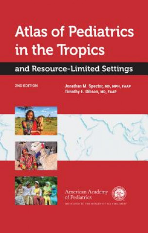 Kniha Atlas of Pediatrics in the Tropics and Resource-Limited Settings Jonathan M Spector