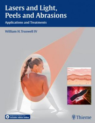Carte Lasers and Light, Peels and Abrasions William H. Truswell