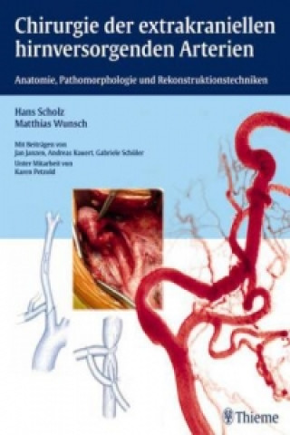 Carte Chirurgie der extrakraniellen hirnversorgenden Arterien Hans Scholz