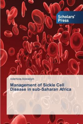 Knjiga Management of Sickle Cell Disease in sub-Saharan Africa Adewoyin Ademola