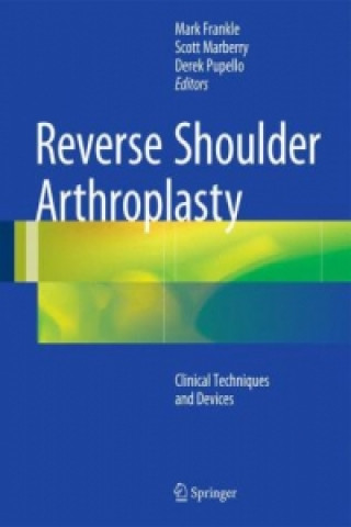 Könyv Reverse Shoulder Arthroplasty Mark Frankle