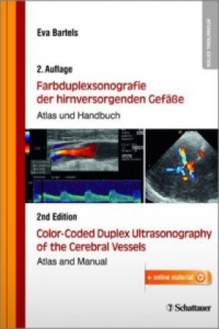 Kniha Farbduplexsonografie der hirnversorgenden Gefäße / Color-Coded Duplex Ultrasonography of the Cerebral Vessels Eva Bartels