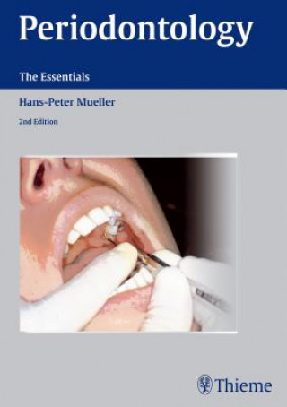 Книга Periodontology Hans-Peter Müller