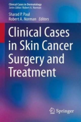 Kniha Clinical Cases in Skin Cancer Surgery and Treatment Sharad P. Paul