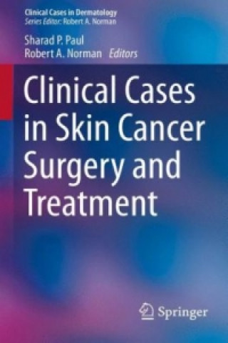 Książka Clinical Cases in Skin Cancer Surgery and Treatment Sharad P. Paul