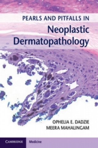 Könyv Pearls and Pitfalls in Neoplastic Dermatopathology with Online Access Ophelia E. Dadzie