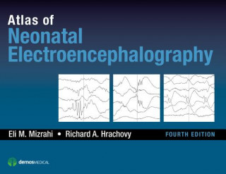 Książka Atlas of Neonatal Electroencephalography Eli M. Mizrahi
