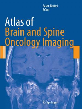Carte Atlas of Brain and Spine Oncology Imaging Sasan Karimi