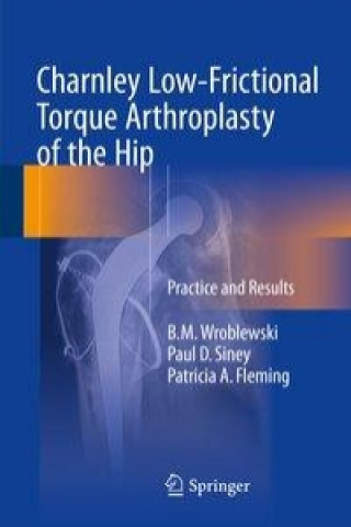 Książka Charnley Low-Frictional Torque Arthroplasty of the Hip B. M. Wroblewski