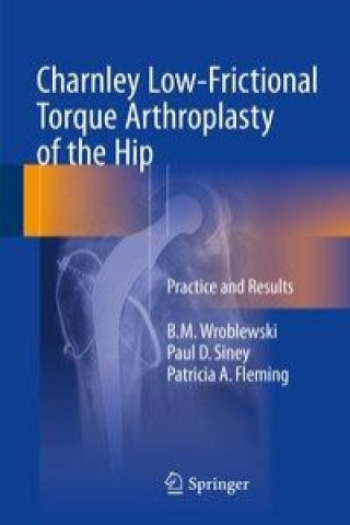 Книга Charnley Low-Frictional Torque Arthroplasty of the Hip B. M. Wroblewski