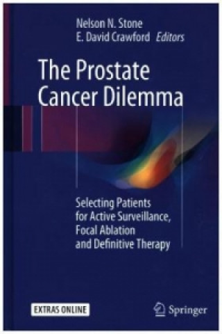 Knjiga Prostate Cancer Dilemma Nelson N. Stone