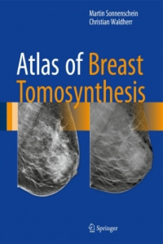 Knjiga Atlas of Breast Tomosynthesis Martin Sonnenschein