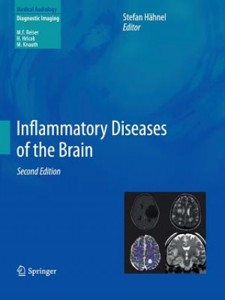 Livre Inflammatory Diseases of the Brain Stefan Hähnel