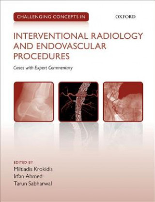 Knjiga Challenging Concepts in Interventional Radiology Miltiadis Krokidis