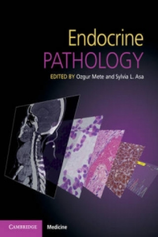 Książka Endocrine Pathology with Online Resource Ozgur Mete