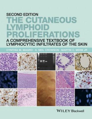 Könyv Cutaneous Lymphoid Proliferations - A Comprehensive Textbook of Lymphocytic Infiltrates of the Skin Cynthia M. Magro