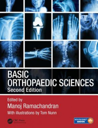 Kniha Basic Orthopaedic Sciences Manoj Ramachandran
