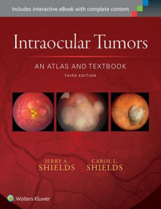 Knjiga Intraocular Tumors: An Atlas and Textbook Jerry Shields