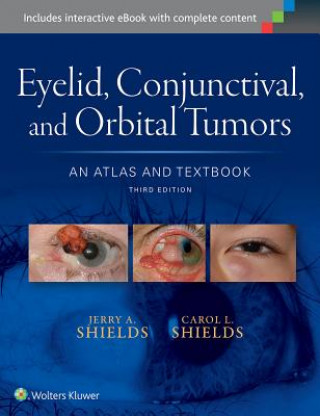Carte Eyelid, Conjunctival, and Orbital Tumors: An Atlas and Textbook Carol Shields