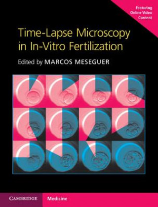 Könyv Time-Lapse Microscopy in In-Vitro Fertilization Hardback with Online Resource Marcos Meseguer