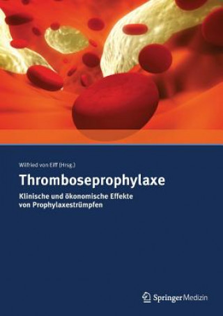 Книга Thromboseprophylaxe Klinische Und Okonomische Effekte Von Prophylaxestrumpfen Wilfried Von Eiff