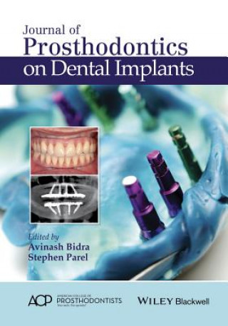 Carte Journal of Prosthodontics on Dental Implants Stephen M. Parel