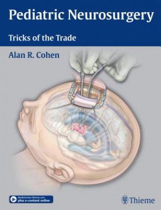 Kniha Pediatric Neurosurgery: Tricks of the Trade Alan R. Cohen