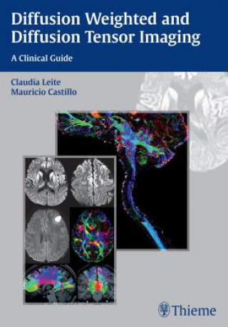 Kniha Diffusion Weighted and Diffusion Tensor Imaging Mauricio Castillo