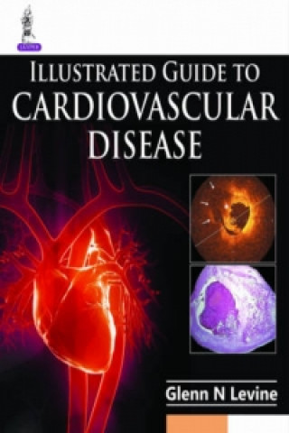 Könyv Illustrated Guide to Cardiovascular Disease N Glenn Levine