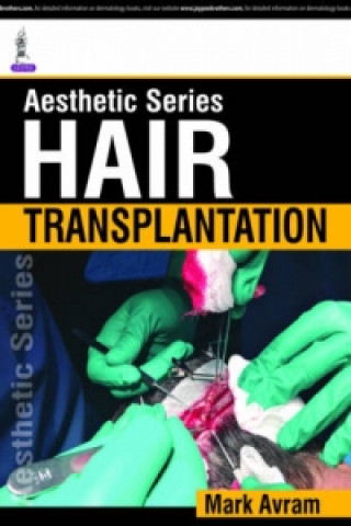 Книга Aesthetic Series - Hair Transplantation R Marc Avram