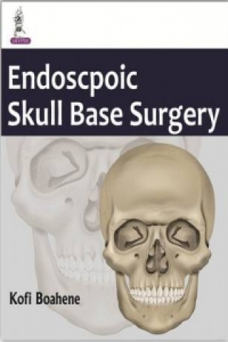 Knjiga Minimal Access Skull Base Surgery Kofi Boahene