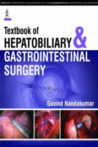 Book Evidence Based Practices in Gastrointestinal & Hepatobiliary Surgery Govind Nandakumar