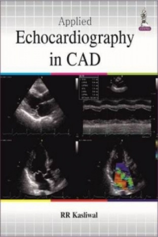 Carte Applied Echocardiography in Coronary Artery Disease RR Kasliwal