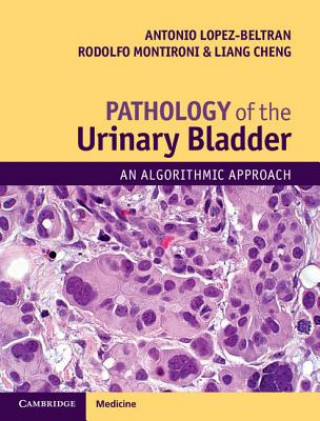 Kniha Pathology of the Urinary Bladder Antonio Lopez-Beltran