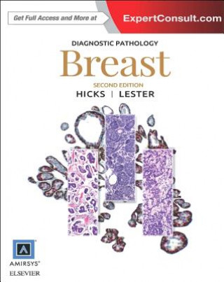 Carte Diagnostic Pathology: Breast Susan C. Lester