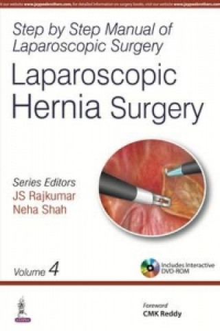 Könyv Step by Step Manual of Laparoscopic Surgery Neha Shah
