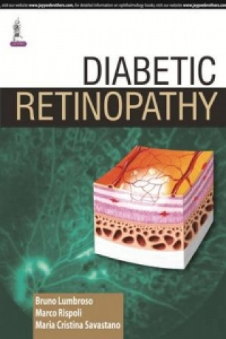 Книга Diabetic Retinopathy Maria Cristina Savastano