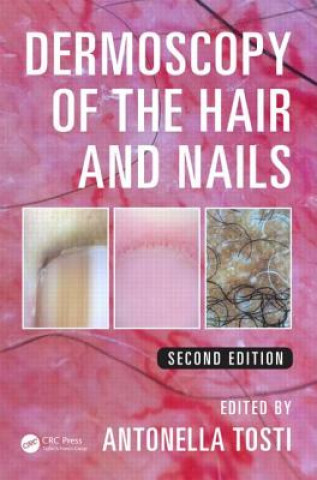 Carte Dermoscopy of the Hair and Nails Antonella Tosti