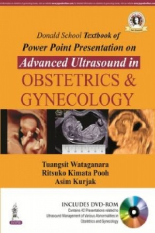 Kniha Donald School Textbook of Powerpoint Presentation on Advanced Ultrasound in Obstetrics & Gynecology Tuangsit Wataganara
