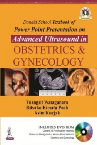 Książka Donald School Textbook of Powerpoint Presentation on Advanced Ultrasound in Obstetrics & Gynecology Tuangsit Wataganara