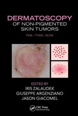 Könyv Dermatoscopy of Non-Pigmented Skin Tumors 