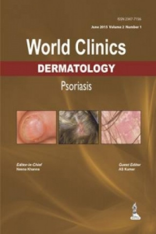 Könyv World Clinics: Dermatology: Psoriasis Neena Khanna