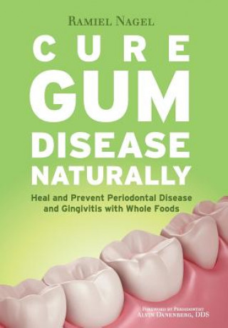 Carte Cure Gum Disease Naturally Ramiel Nagel