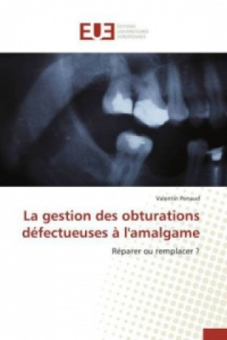 Книга La Gestion Des Obturations Defectueuses A l'Amalgame Penaud Valentin