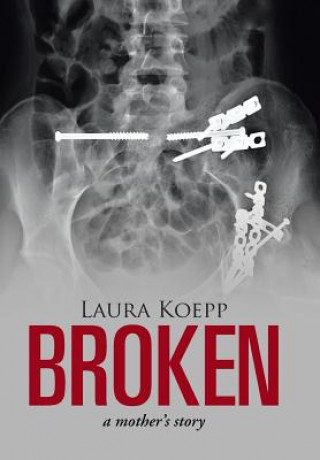 Kniha Broken Laura Koepp