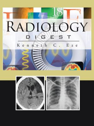 Kniha Radiology Digest Kenneth C Eze